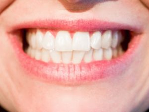 Dents blanches : 5 astuces pour voir la différence